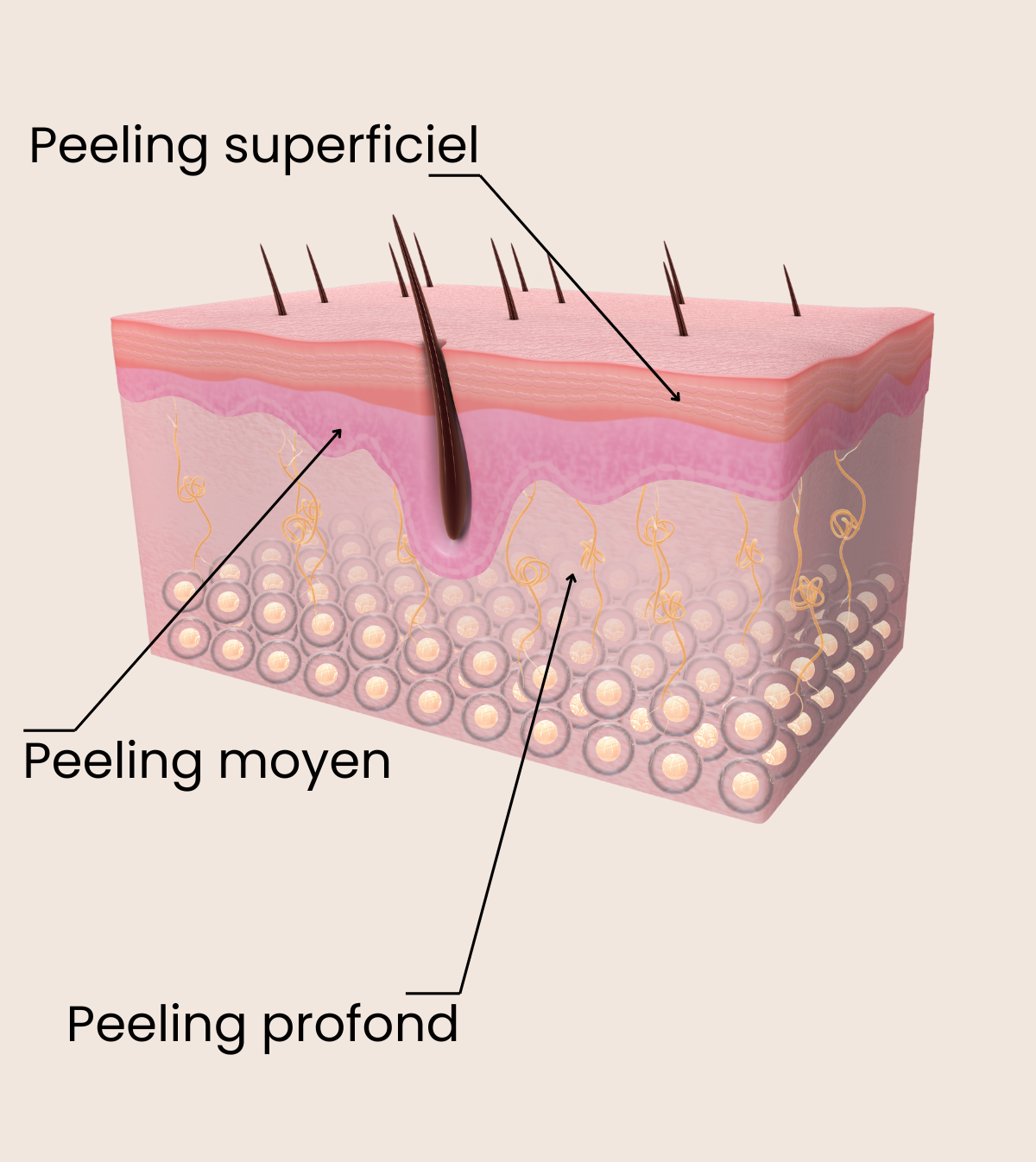 faire un peeling professionnel à sainte croix